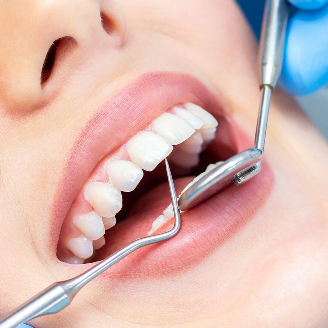 Branko Dental Tehno